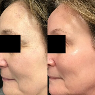 Skin Treatment #9727 Marge Image