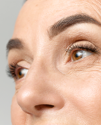 Eyelid Surgery (Blepharoplasty) Featured Image