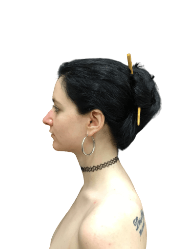 Rhinoplasty #6038 Before Image