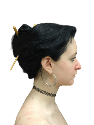 Rhinoplasty #6038 Before Image